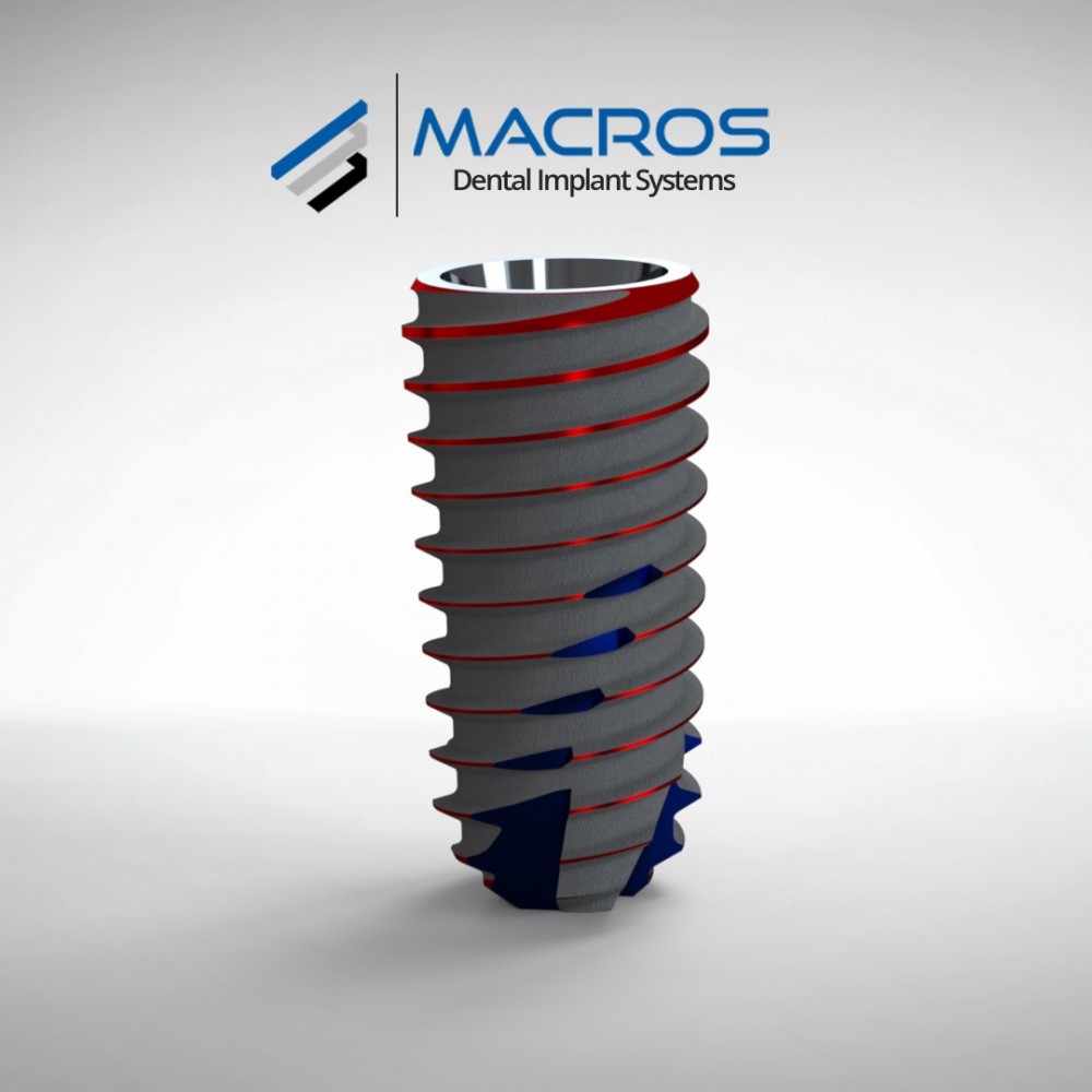 Macros |  Dental Implant - Fixture